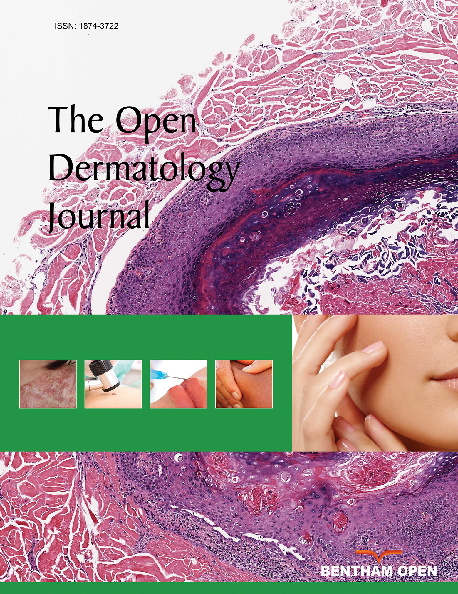 The Open Dermatology Journal